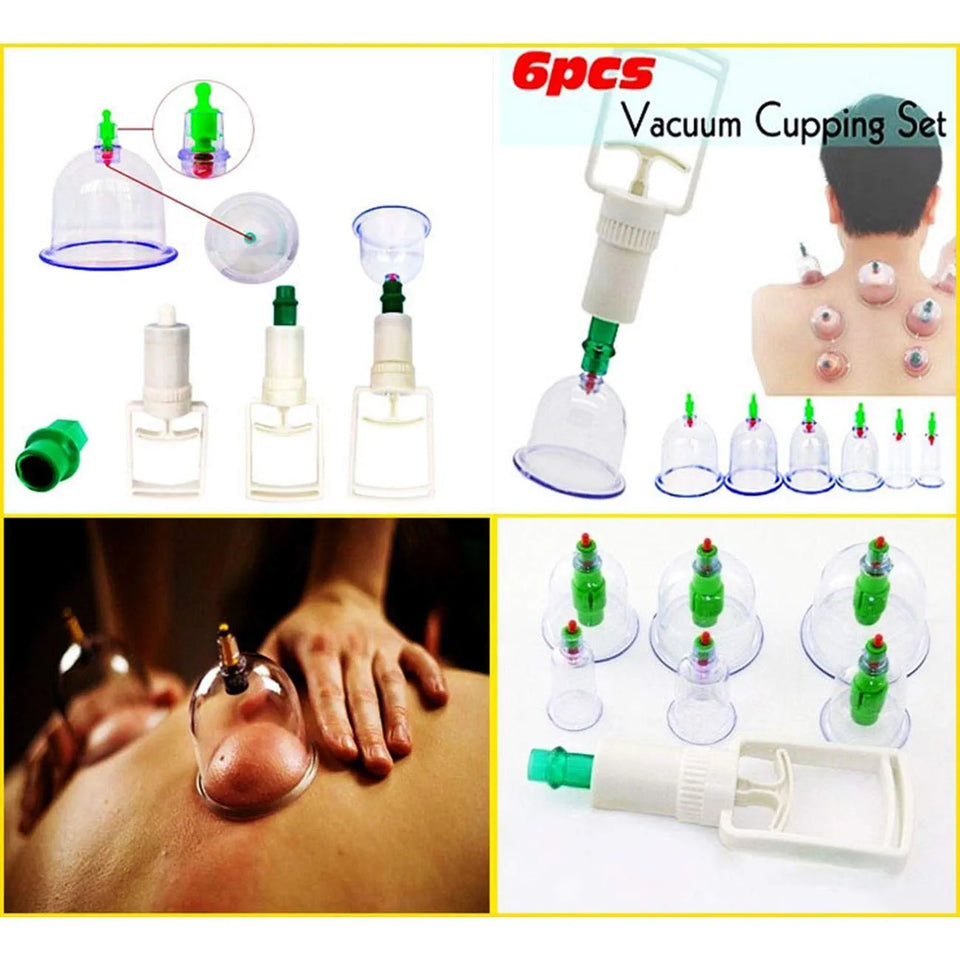 Hijama Cupping Therapy Tools kit ( 6 cups + pump )
