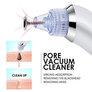 4 in 1 Derma Vacuum Suction Blackhead/Acne/Oil/Pore Cleaner 🌞💁‍♀️